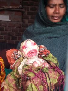 एलियन जैसा दिखने वाला बच्चे का जन्म लोगों के लिए चर्चा का विषय बना