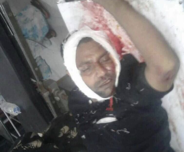 दाऊदनगर-पटना रोड पर बाइक चालक दुर्घटनाग्रस्त