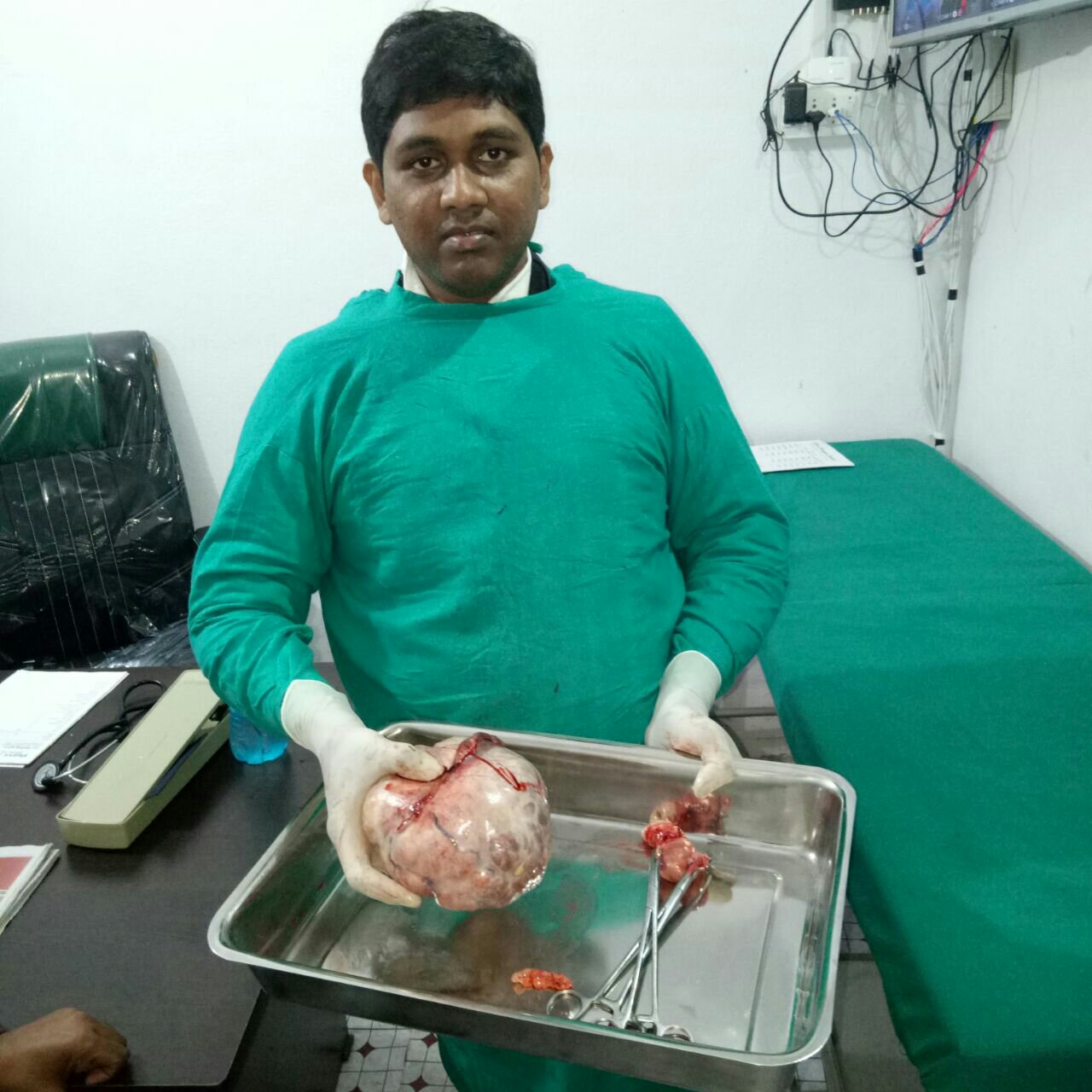 महिला के पेट से निकला 3.5 किलो का ट्यूमर, 