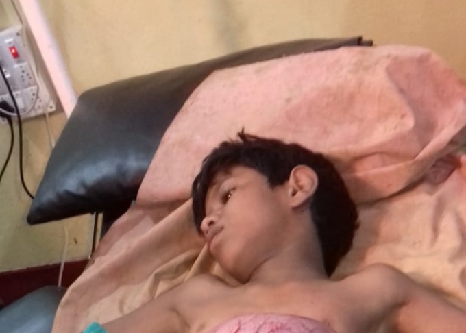 जंगली सुअर के हमले से बालक घायल